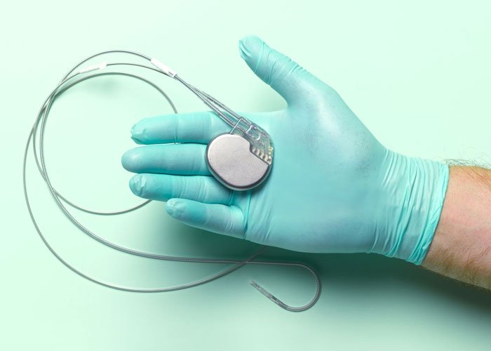 Pacemaker Implant